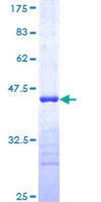 SDS-Page: Recombinant Human RNF6 Protein [H00006049-Q01] - 12.5% SDS-PAGE Stained with Coomassie Blue.