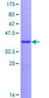 12.5% SDS-PAGE Stained with Coomassie Blue.