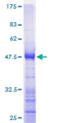 SDS-Page: Recombinant Human Ribosomal Protein L17 Protein [H00006139-P01] - 12.5% SDS-PAGE Stained with Coomassie Blue.