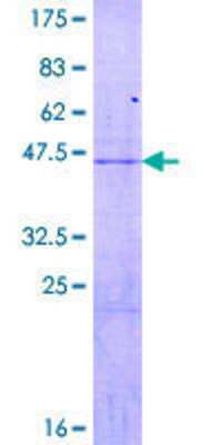 12.5% SDS-PAGE Stained with Coomassie Blue.