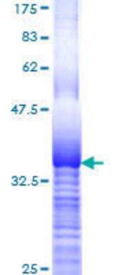 SDS-Page: Recombinant Human RPL29 Protein [H00006159-Q01] - 12.5% SDS-PAGE Stained with Coomassie Blue.