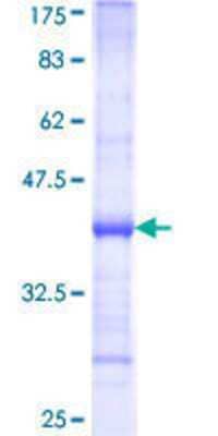 SDS-Page: Recombinant Human RPL32 Protein [H00006161-Q01] - 12.5% SDS-PAGE Stained with Coomassie Blue.
