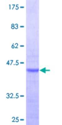 12.5% SDS-PAGE Stained with Coomassie Blue.