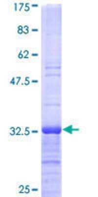 12.5% SDS-PAGE Stained with Coomassie Blue.