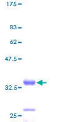 12.5% SDS-PAGE Stained with Coomassie Blue.