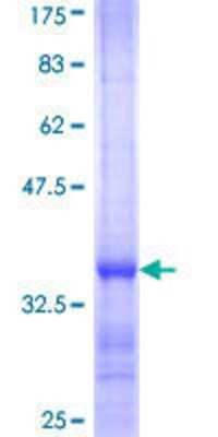 SDS-Page: Recombinant Human RPL38 Protein [H00006169-Q01] - 12.5% SDS-PAGE Stained with Coomassie Blue.