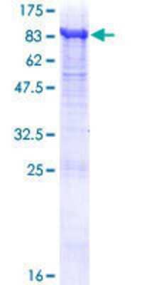 12.5% SDS-PAGE Stained with Coomassie Blue.