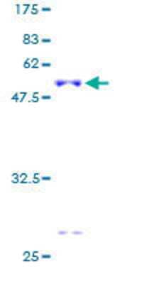 12.5% SDS-PAGE Stained with Coomassie Blue.