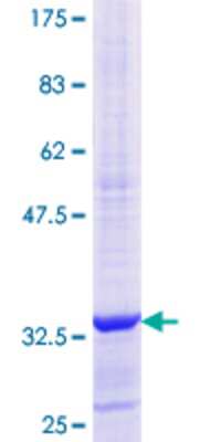 SDS-Page: Recombinant Human RPS15A Protein [H00006210-Q01] - 12.5% SDS-PAGE Stained with Coomassie Blue.