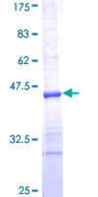 SDS-Page: Recombinant Human RPS23 Protein [H00006228-Q01] - 12.5% SDS-PAGE Stained with Coomassie Blue.