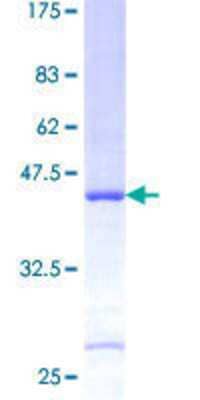 12.5% SDS-PAGE Stained with Coomassie Blue.