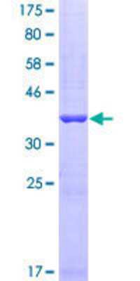 12.5% SDS-PAGE Stained with Coomassie Blue.