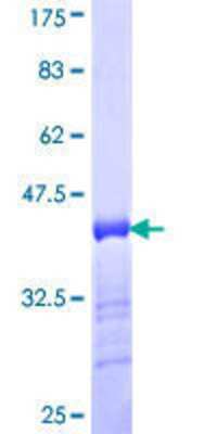 SDS-Page: Recombinant Human RSC1A1 Protein [H00006248-Q01] - 12.5% SDS-PAGE Stained with Coomassie Blue.
