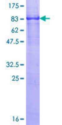 SDS-Page: Recombinant Human Reticulon 2 Protein [H00006253-P01] - 12.5% SDS-PAGE Stained with Coomassie Blue.