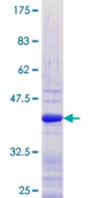 12.5% SDS-PAGE Stained with Coomassie Blue.