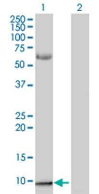 Lane 1: S100A2 transfected lysate (10.78 KDa). Lane 2: Non-transfected lysate.