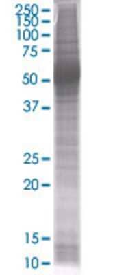 Other S100A8 293T Cell Transient Overexpression Lysate