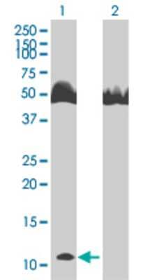 Lane 1: S100A8 transfected lysate (10.34 KDa). Lane 2: Non-transfected lysate.