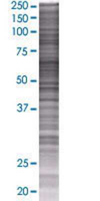 ACSM3 transfected lysate.
