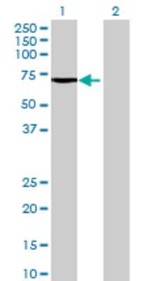 Lane 1: ACSM3 transfected lysate (64.57 KDa) Lane 2: Non-transfected lysate.