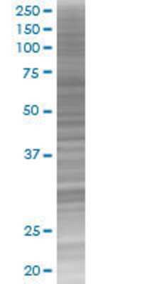 SALL2 transfected lysate.