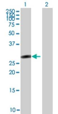 Lane 1: SALL2 transfected lysate (21.89 KDa) Lane 2: Non-transfected lysate.