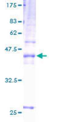 12.5% SDS-PAGE Stained with Coomassie Blue.