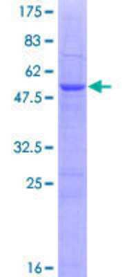 12.5% SDS-PAGE Stained with Coomassie Blue.