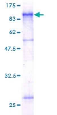 12.5% SDS-PAGE Stained with Coomassie Blue.