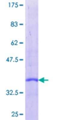 SDS-Page: Recombinant Human Secretin Protein [H00006343-P01] - 12.5% SDS-PAGE Stained with Coomassie Blue.