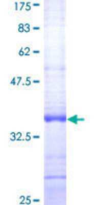 12.5% SDS-PAGE Stained with Coomassie Blue.