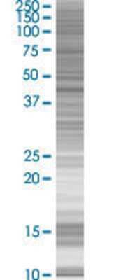SETMAR transfected lysate.