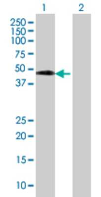 Lane 1: SETMAR transfected lysate (38.83 KDa) Lane 2: Non-transfected lysate.