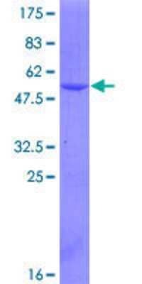 12.5% SDS-PAGE Stained with Coomassie Blue.