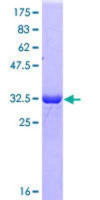 12.5% SDS-PAGE Stained with Coomassie Blue.