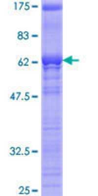 SDS-PAGE Recombinant Human SFRS5 GST (N-Term) Protein