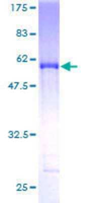 Other Recombinant Human SH3BGR GST (N-Term) Protein