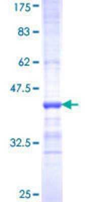 12.5% SDS-PAGE Stained with Coomassie Blue.