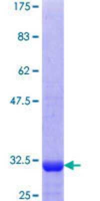 12.5% SDS-PAGE Stained with Coomassie Blue.