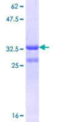 12.5% SDS-PAGE Stained with Coomassie Blue.