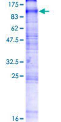 12.5% SDS-PAGE Stained with Coomassie Blue.