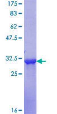 SDS-Page: Recombinant Human SLC7A2 Protein [H00006542-Q01] - 12.5% SDS-PAGE Stained with Coomassie Blue.