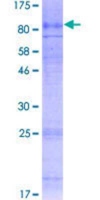12.5% SDS-PAGE Stained with Coomassie Blue.