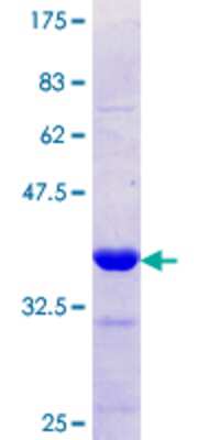 SDS-Page: Recombinant Human NKCC2/SLC12A1 Protein [H00006557-Q01] - 12.5% SDS-PAGE Stained with Coomassie Blue.