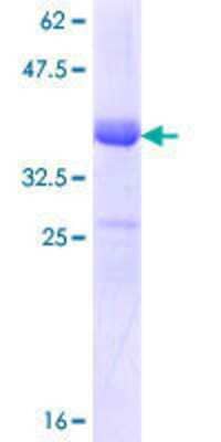 SDS-Page: Recombinant Human NKCC1/SLC12A2 Protein [H00006558-Q01] - 12.5% SDS-PAGE Stained with Coomassie Blue.