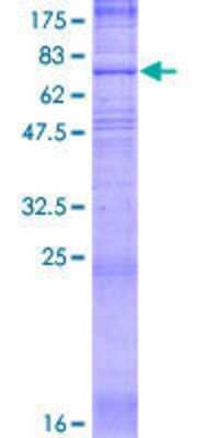 Other Recombinant Human Reduced Folate Carrier/SLC19A1 GST (N-Term) Protein