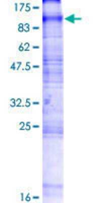 12.5% SDS-PAGE Stained with Coomassie Blue.