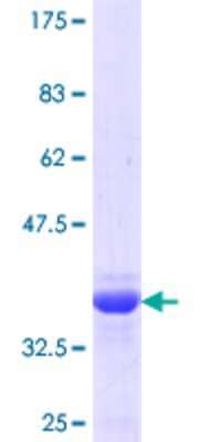 12.5% SDS-PAGE Stained with Coomassie Blue.