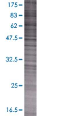 SLC20A2 transfected lysate.