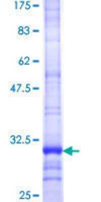 12.5% SDS-PAGE Stained with Coomassie Blue.